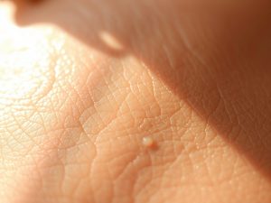 Kiedy zgłosić się do dermatologa ze zmarszczkami: sygnały, diagnostyka i bezpieczne metody pielęgnacji skóry